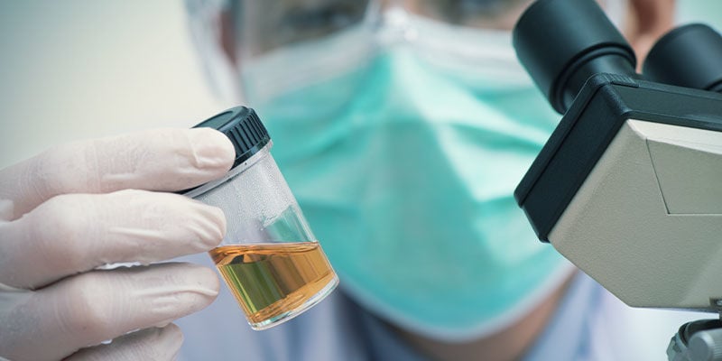 Ejemplos De Lo Que Busca Un Laboratorio En Una Muestra De Orina