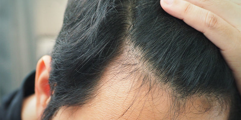Cabello, piel y uñas