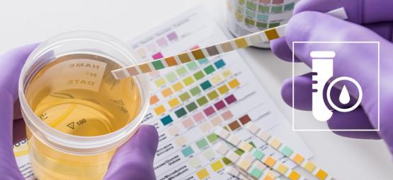 Cómo Superar Una Prueba De Detección De THC (2025)